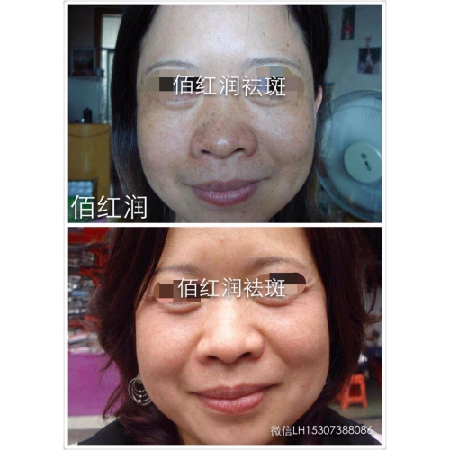 前后對(duì)比照